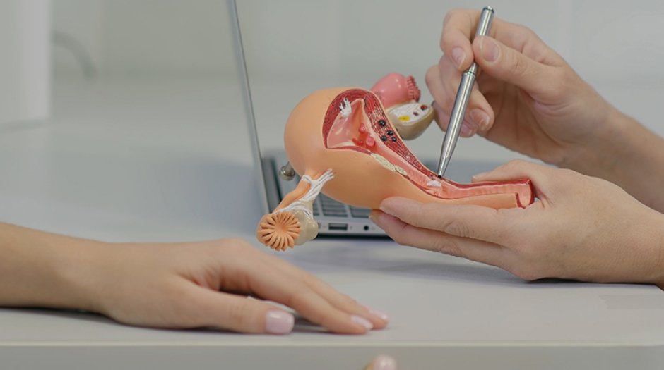 Mioma uterino: ¿Que es? Diagnóstico y tratamiento.